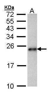 Anti-CRHSP-24 Antibody