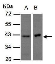 Anti-NDUFA10 Antibody