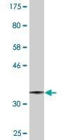 Anti-UGCG Antibody