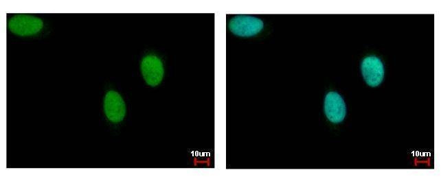 Anti-DNA ligase III Antibody