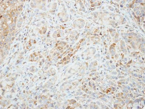Anti-AMPK alpha 2 Antibody