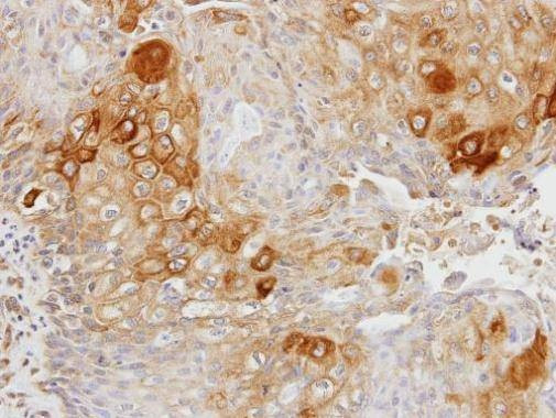 Anti-Glycerol kinase 2 Antibody