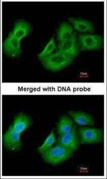 Anti-UAP1 Antibody