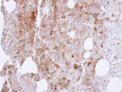 Anti-UAP1 Antibody
