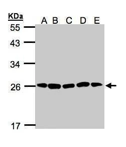 Anti-Proteasome 20S alpha 2 Antibody