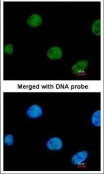 Anti-ZNF211 (internal) Antibody