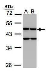 Anti-Creatine kinase 1B Antibody