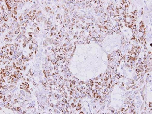 Anti-Creatine kinase 1B Antibody