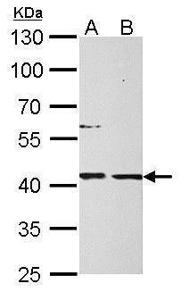 Anti-MPI Antibody