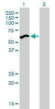 Anti-UHRF2 Antibody