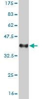 Anti-UHRF2 Antibody