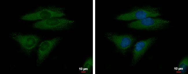 Anti-FGFR-5 Antibody