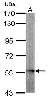 Anti-GLYCTK Antibody