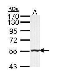 Anti-GLYCTK Antibody