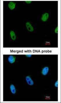 Anti-L3MBTL Antibody