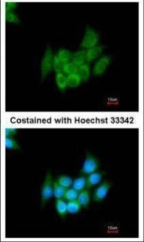 Anti-Angiotensinogen Antibody