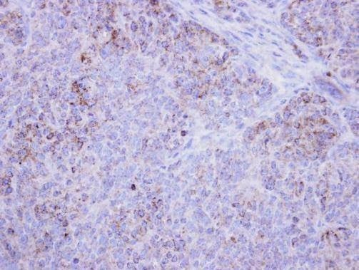 Anti-HSD17B4 Antibody