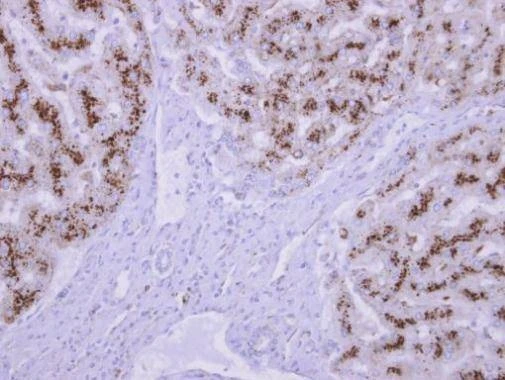 Anti-TPP1 Antibody