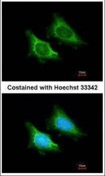 Anti-MRPS5 Antibody