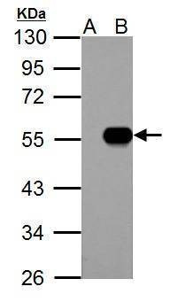 Anti-IP6K1 Antibody
