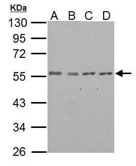 Anti-IP6K1 Antibody