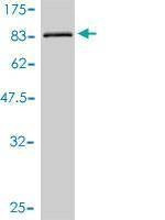 Anti-ULK4 Antibody
