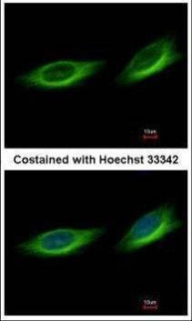 Anti-TULP1 Antibody