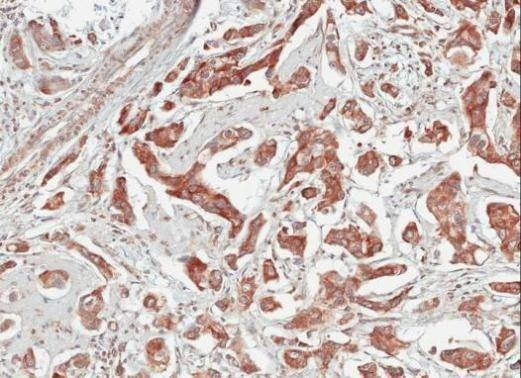 Anti-TULP1 Antibody