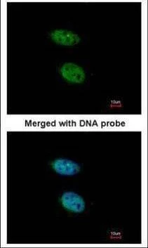Anti-PRPS2 Antibody