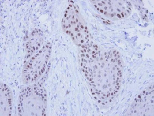 Anti-RFC4 Antibody