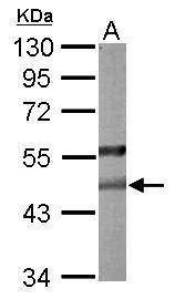 Anti-PON2 Antibody