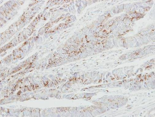 Anti-GALNT2 Antibody