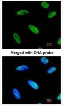 Anti-DNAJC7 Antibody