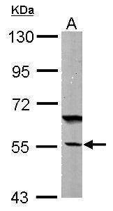 Anti-DNAJC7 Antibody
