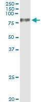 Anti-UMOD Antibody