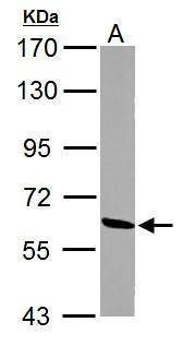 Anti-ME1 Antibody