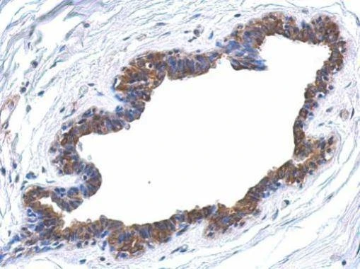 Anti-MAPK4 Antibody