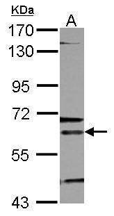 Anti-ALAS-E Antibody