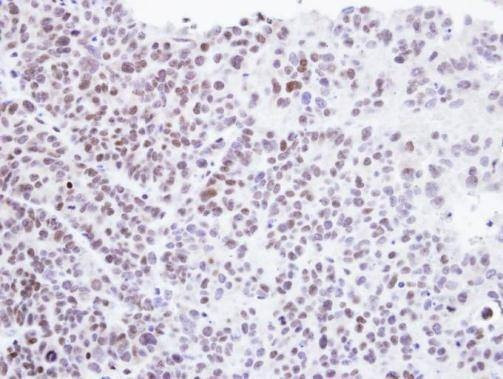 Anti-HMBOX1 Antibody