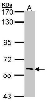 Anti-IRAK3 Antibody