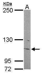 Anti-INPP5F Antibody