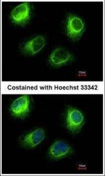 Anti-INPP5F Antibody