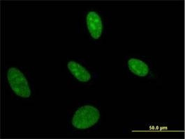 Anti-UMPS Antibody
