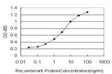 Anti-UMPS Antibody