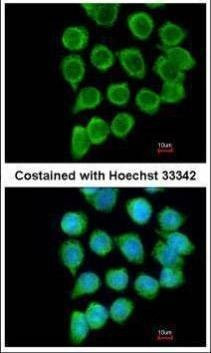 Anti-RELT Antibody