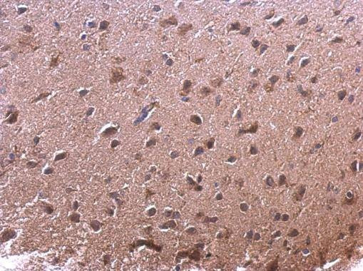 Anti-AKR7A2 Antibody