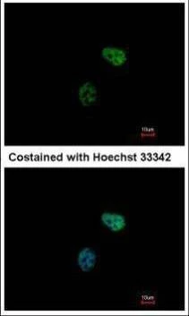Anti-PSMC6 Antibody