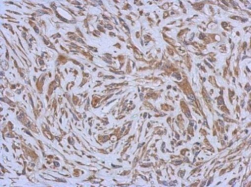 Anti-ENTPD3 Antibody