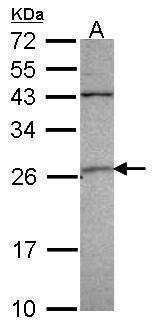 Anti-GSTA4 Antibody