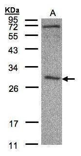 Anti-CLIC3 Antibody